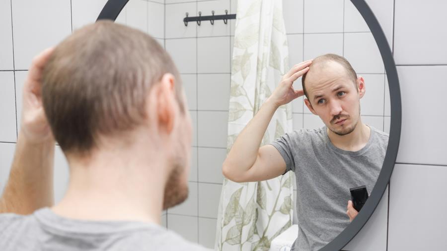 Minoxidil oral : quelle place face au traitement topique ?
