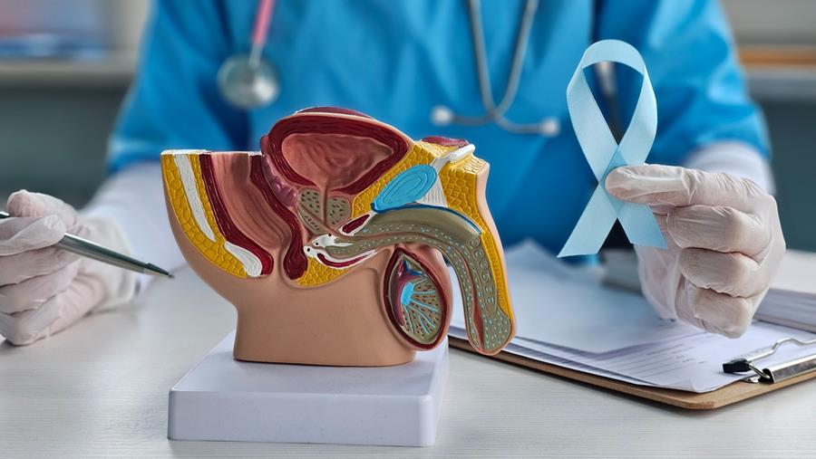 PROTEUS bevestigt nut van intensievere perioperatieve behandeling