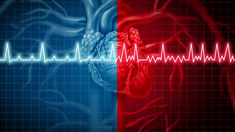CHAMPION-AF: een alternatief voor direct werkende orale anticoagulantia
