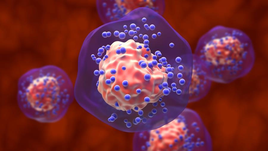 Accès précoce au datopotamab déruxtécan dans le cancer du sein triple négatif